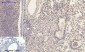 MMP-2 Polyclonal Antibody